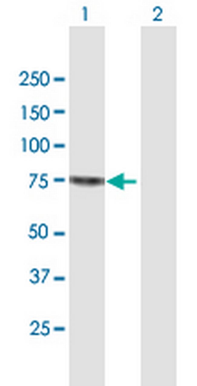SENP2 Antibody in Western Blot (WB)