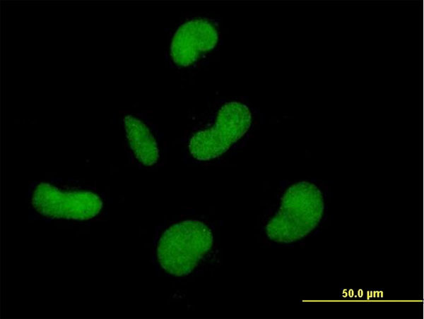ZNF350 Antibody in Immunocytochemistry (ICC/IF)