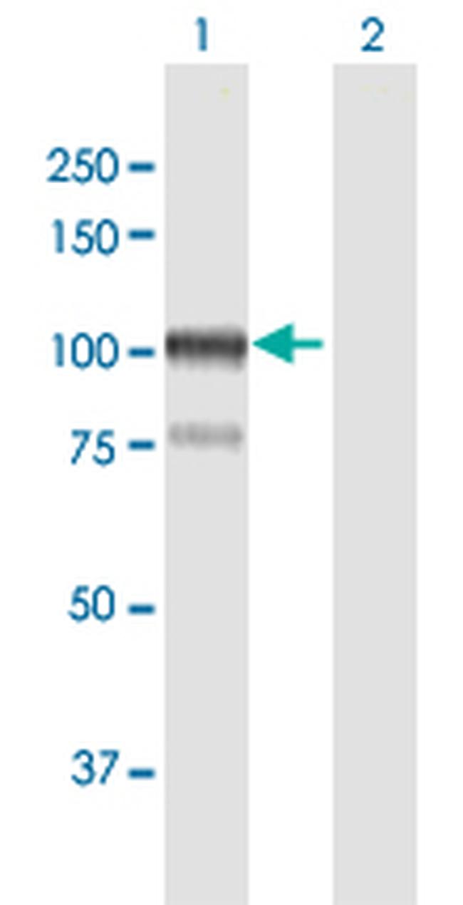 AFAP1 Antibody in Western Blot (WB)