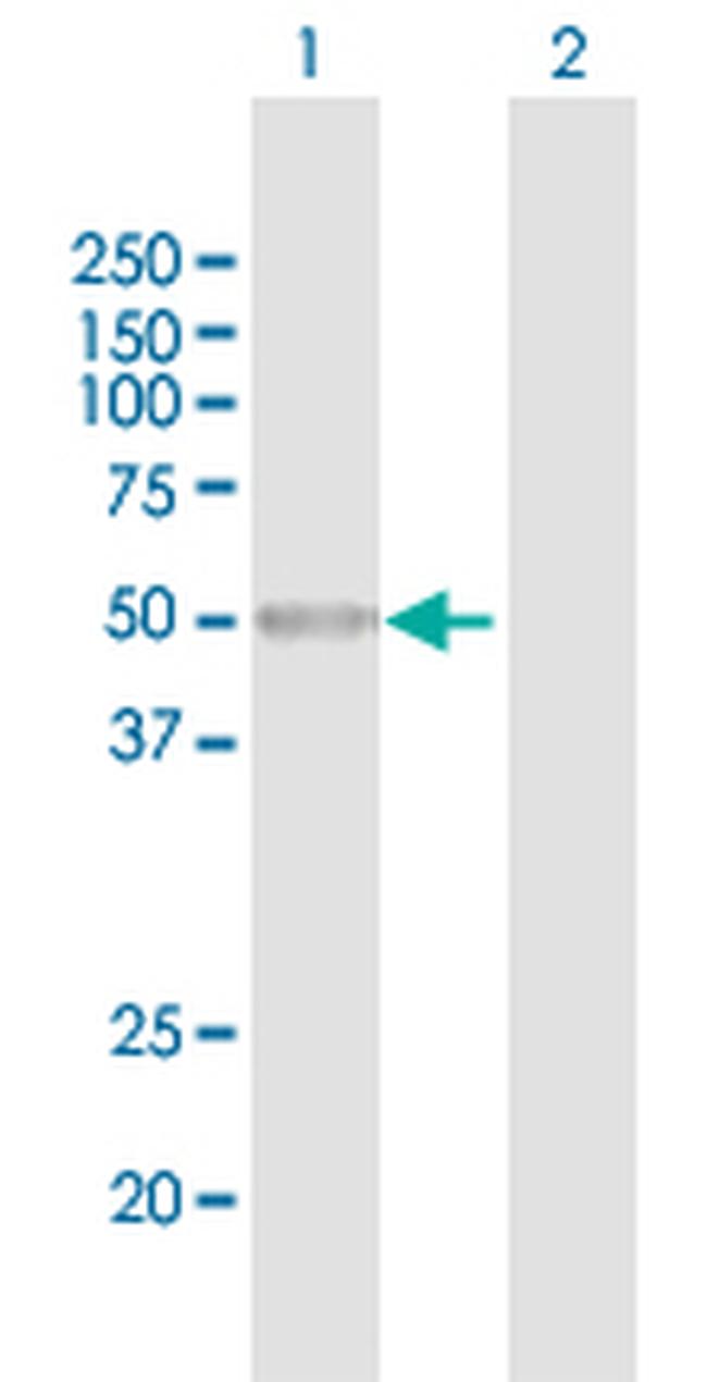 BRUNOL6 Antibody in Western Blot (WB)