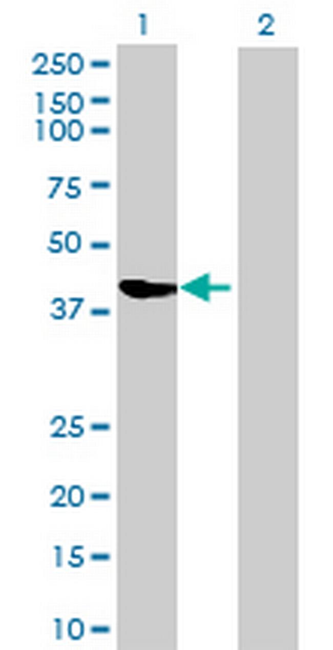 BRUNOL5 Antibody in Western Blot (WB)
