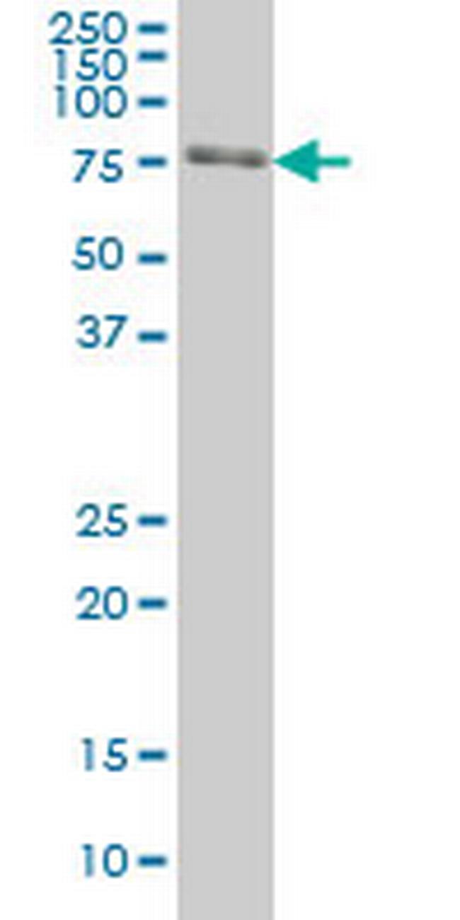 FKBP10 Antibody in Western Blot (WB)