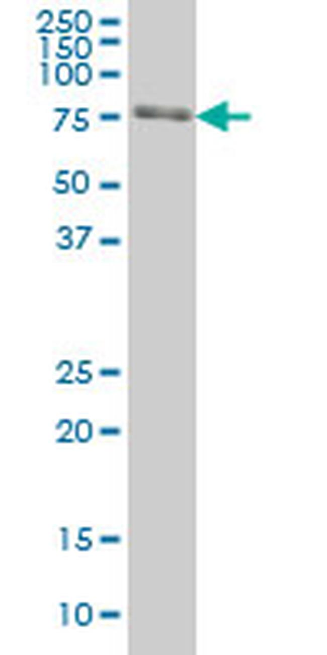 FKBP10 Antibody in Western Blot (WB)