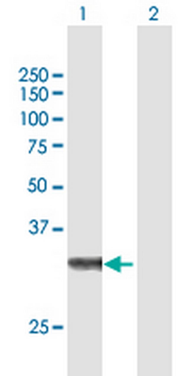 ZFAND3 Antibody in Western Blot (WB)