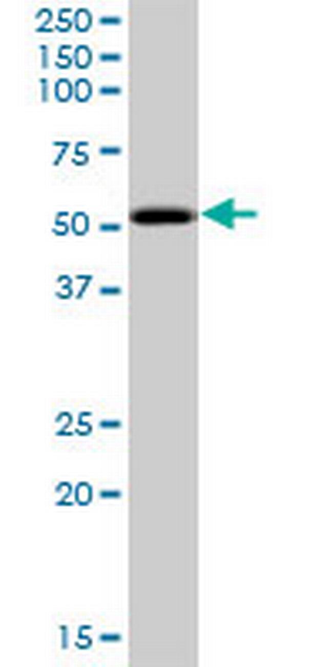 PKNOX2 Antibody in Western Blot (WB)