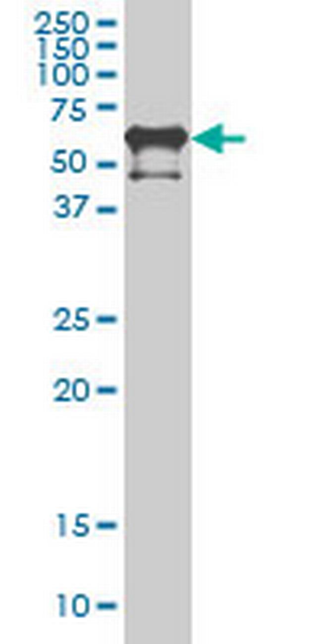 PKNOX2 Antibody in Western Blot (WB)