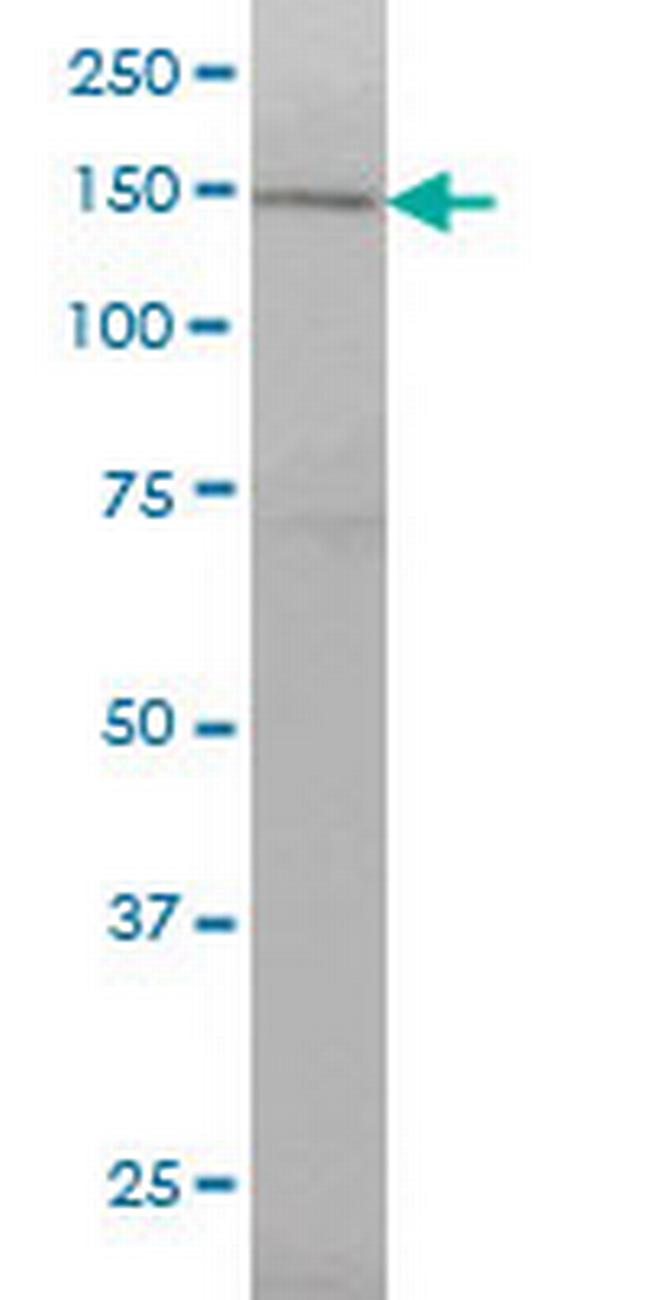RNF123 Antibody in Western Blot (WB)