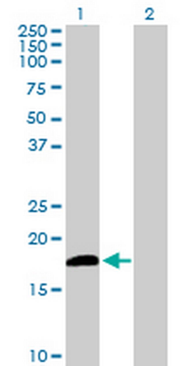 DUSP21 Antibody in Western Blot (WB)