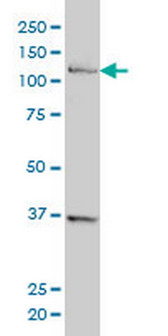 CHTF18 Antibody in Western Blot (WB)