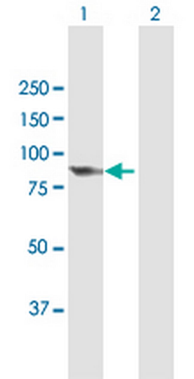 PCIF1 Antibody in Western Blot (WB)