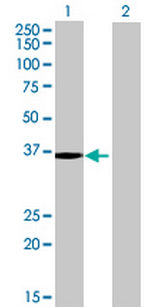 APBA2BP Antibody in Western Blot (WB)