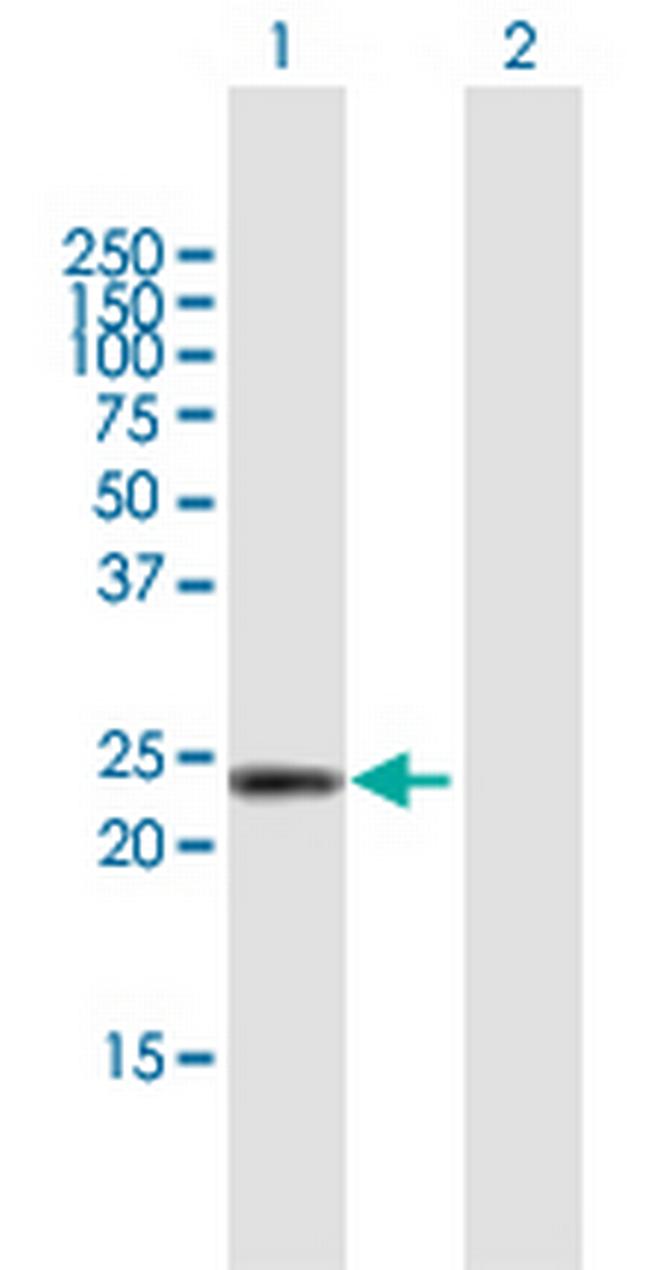 DMRTB1 Antibody in Western Blot (WB)