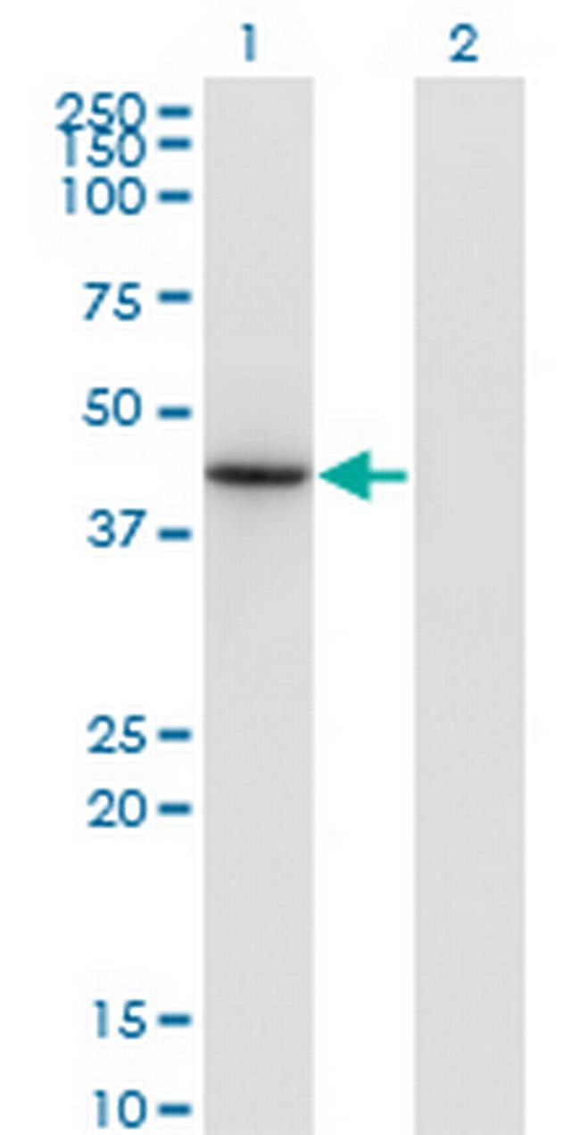 NEUROD6 Antibody in Western Blot (WB)