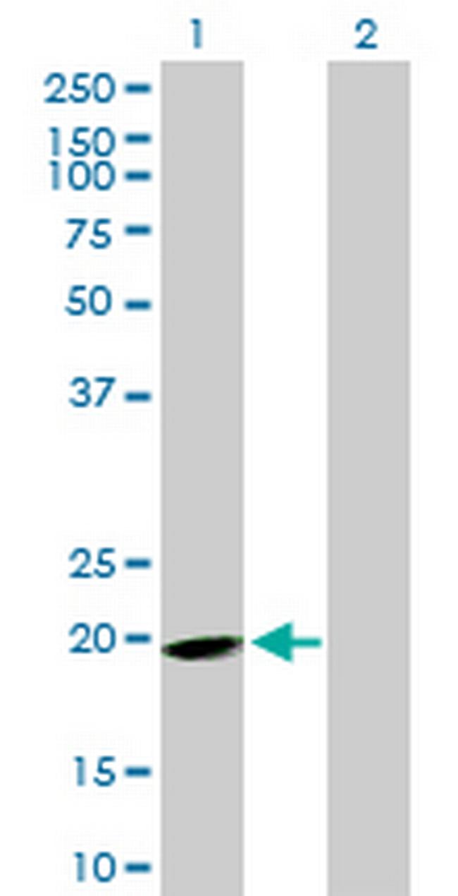 EPB41L4A Antibody in Western Blot (WB)