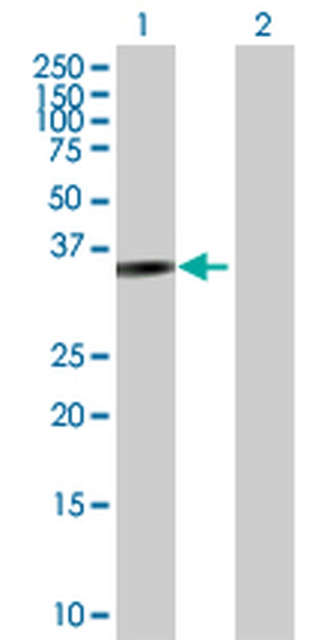 PARVG Antibody in Western Blot (WB)