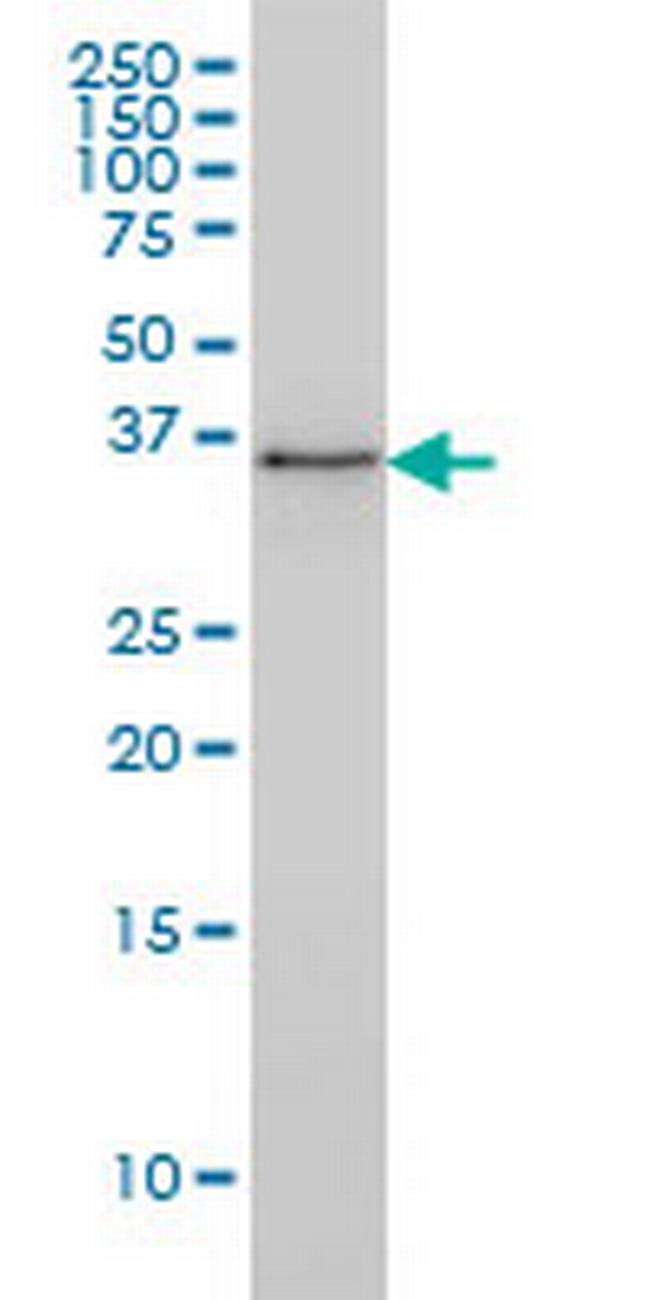 PARVG Antibody in Western Blot (WB)