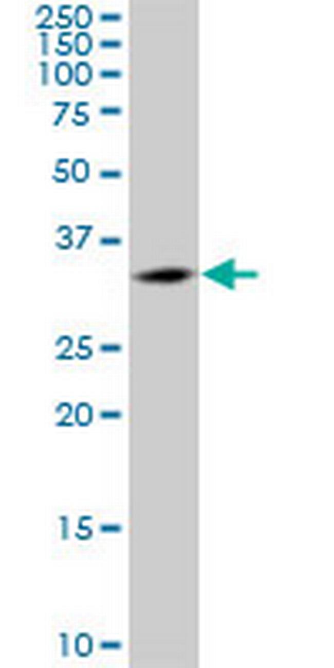 CENPK Antibody in Western Blot (WB)