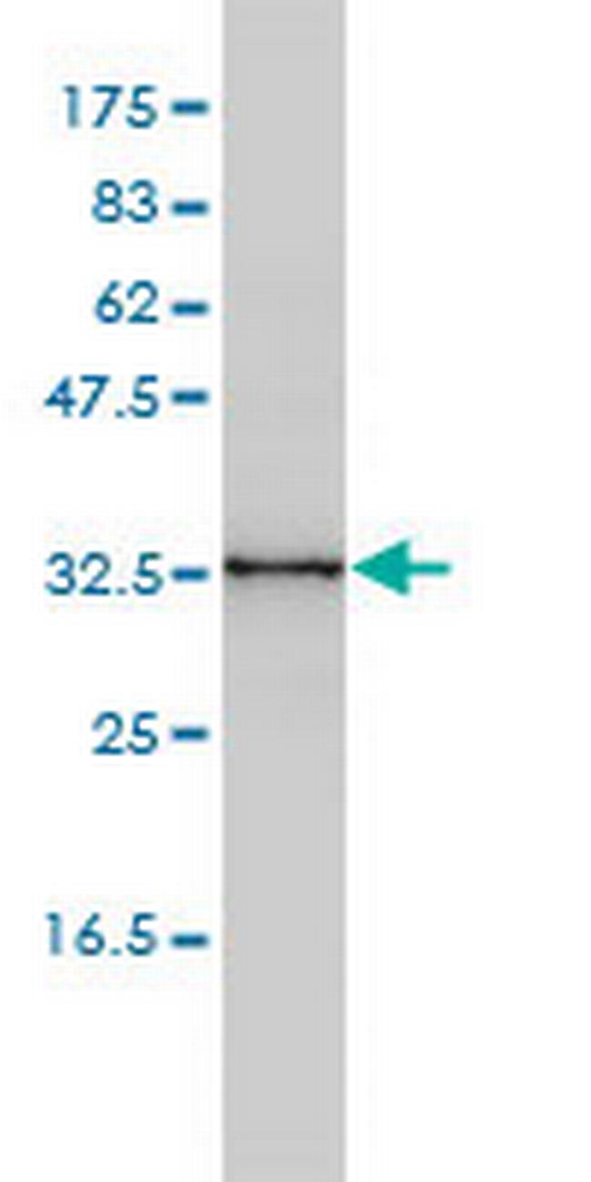CENPK Antibody in Western Blot (WB)