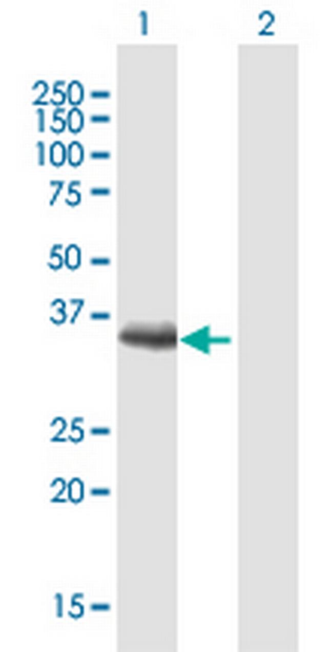 MAGEF1 Antibody in Western Blot (WB)