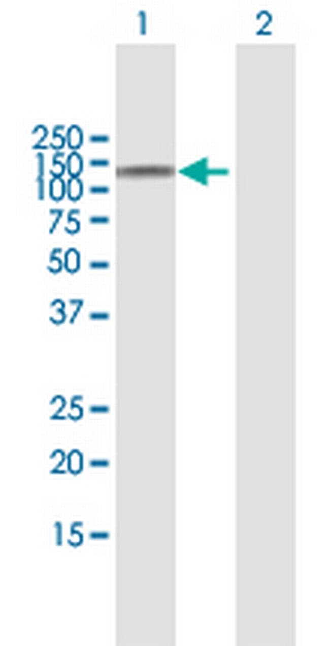 NOD2 Antibody in Western Blot (WB)