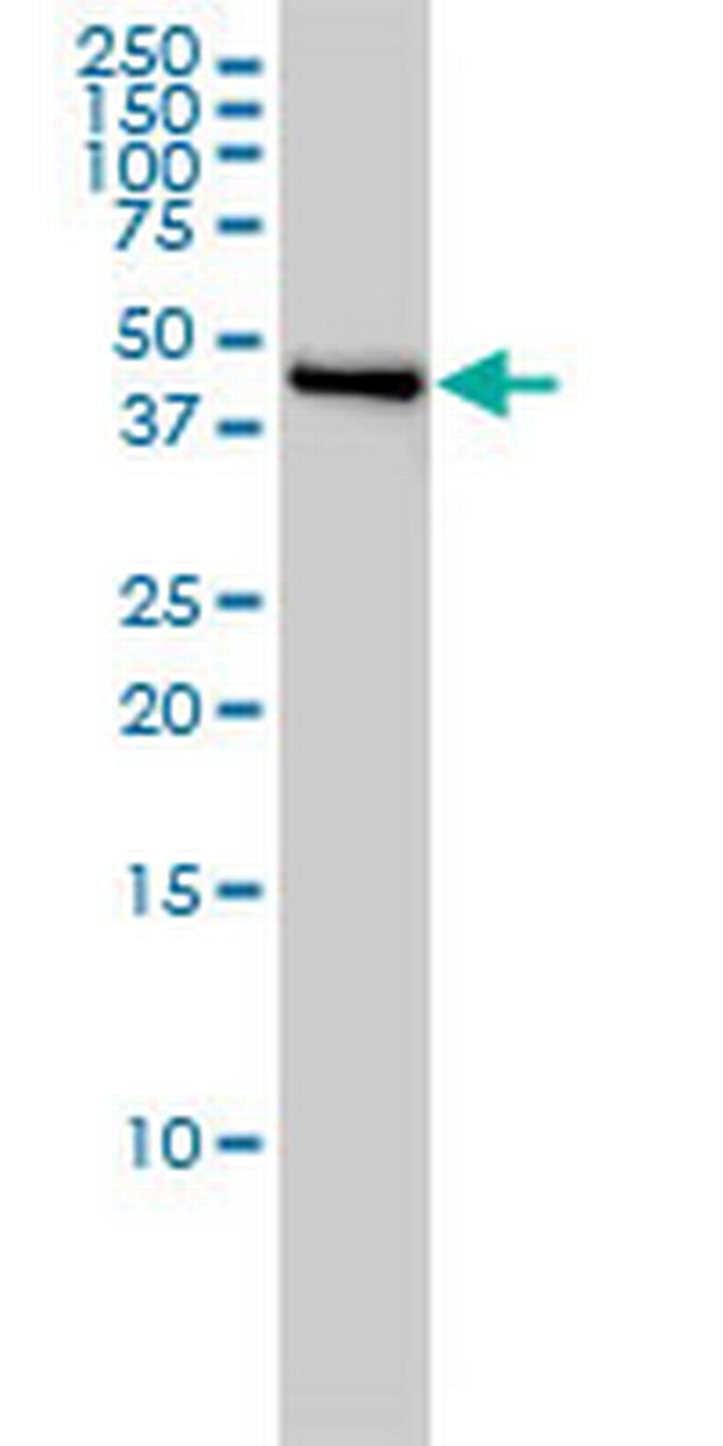 NJMU-R1 Antibody in Western Blot (WB)