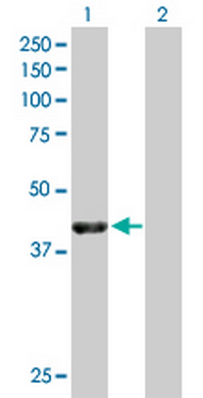 NECAB1 Antibody in Western Blot (WB)