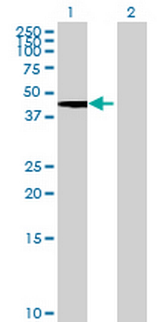 DPEP2 Antibody in Western Blot (WB)