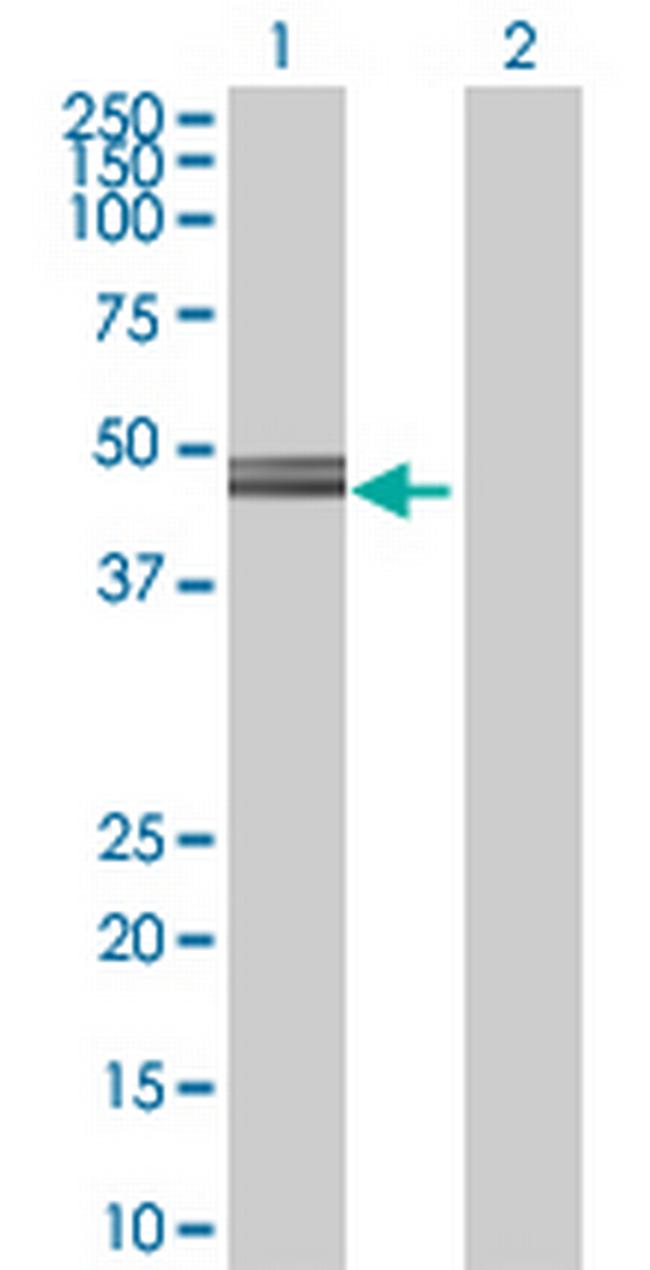 TOR3A Antibody in Western Blot (WB)