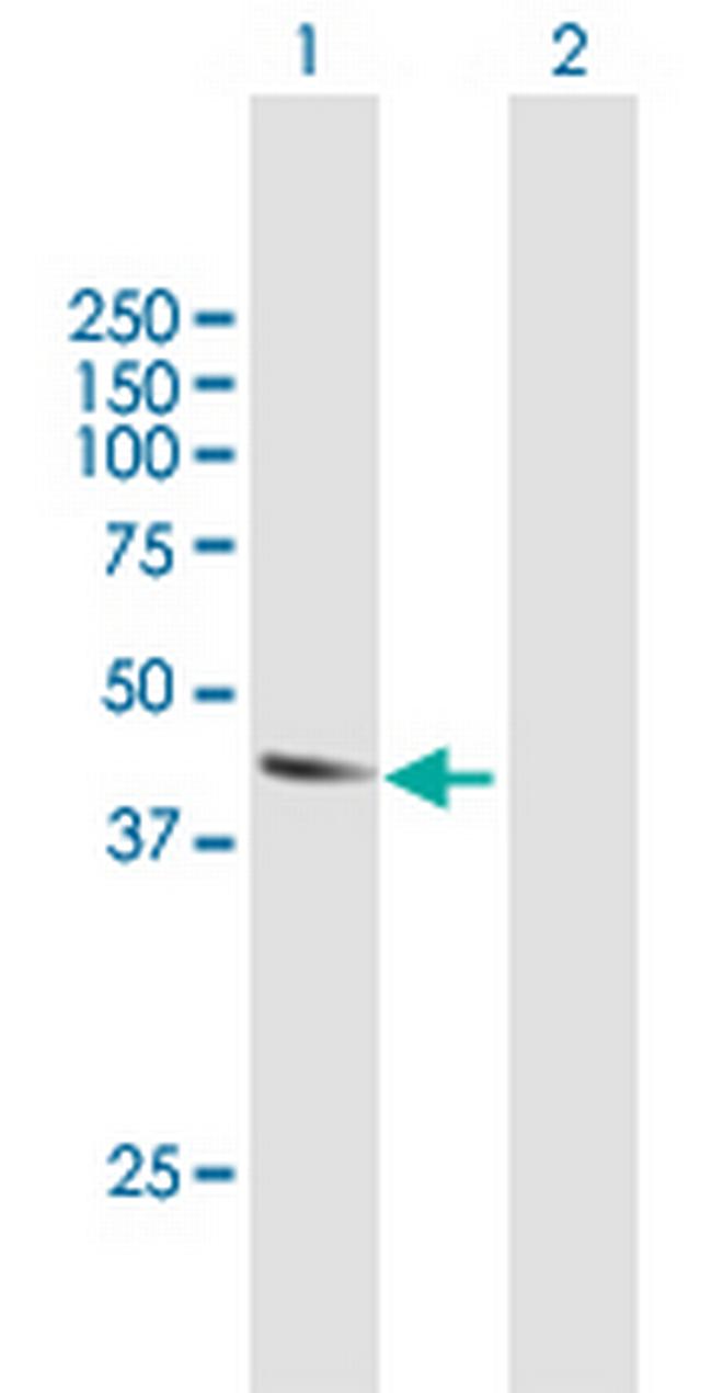 ATL2 Antibody in Western Blot (WB)