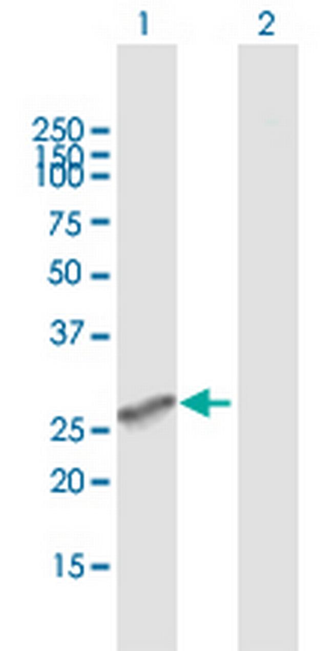 MS4A6A Antibody in Western Blot (WB)