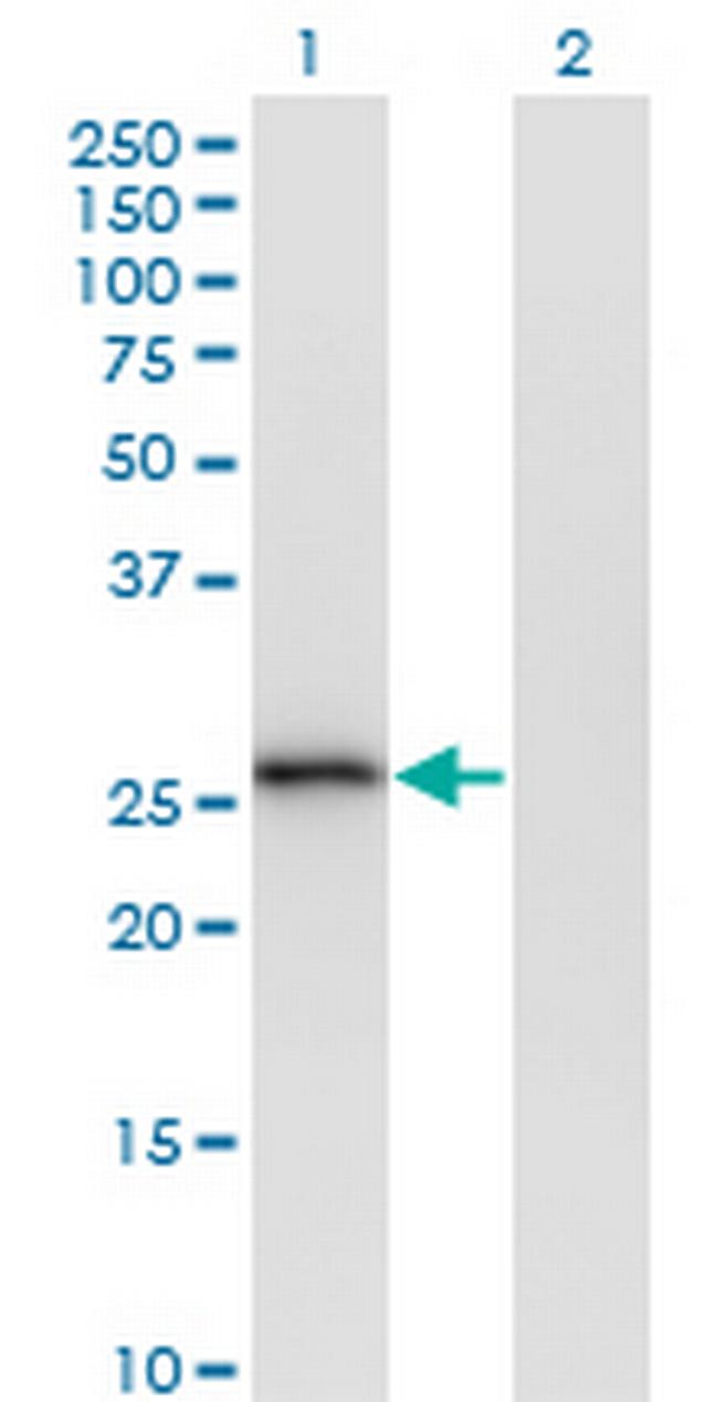 MS4A6A Antibody in Western Blot (WB)
