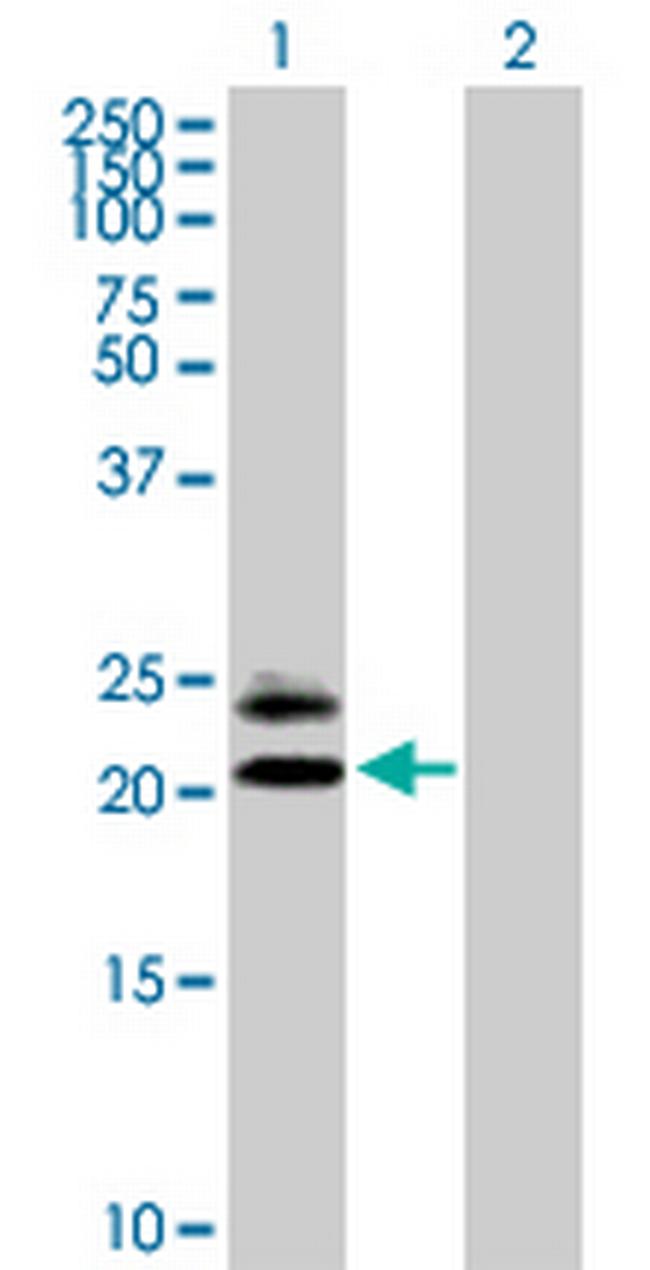 MS4A5 Antibody in Western Blot (WB)