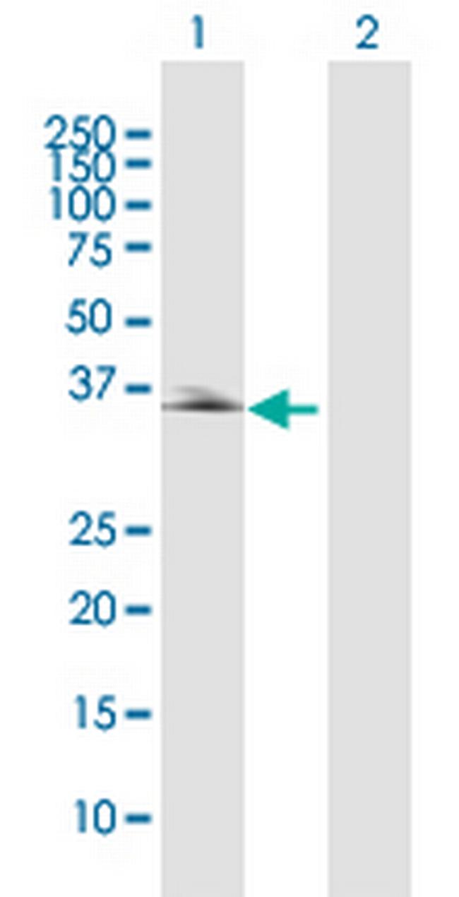 PDLIM2 Antibody in Western Blot (WB)