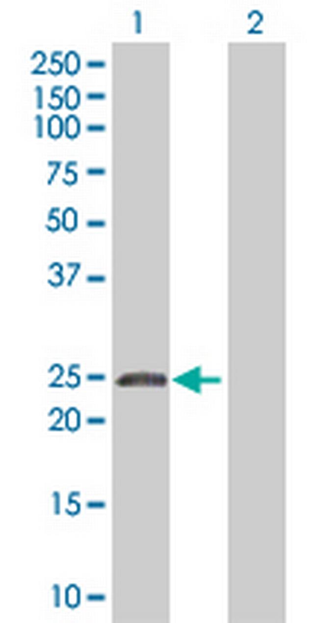 ZNF323 Antibody in Western Blot (WB)