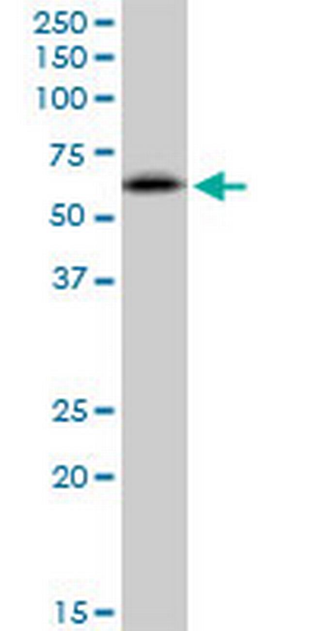 RNF25 Antibody in Western Blot (WB)