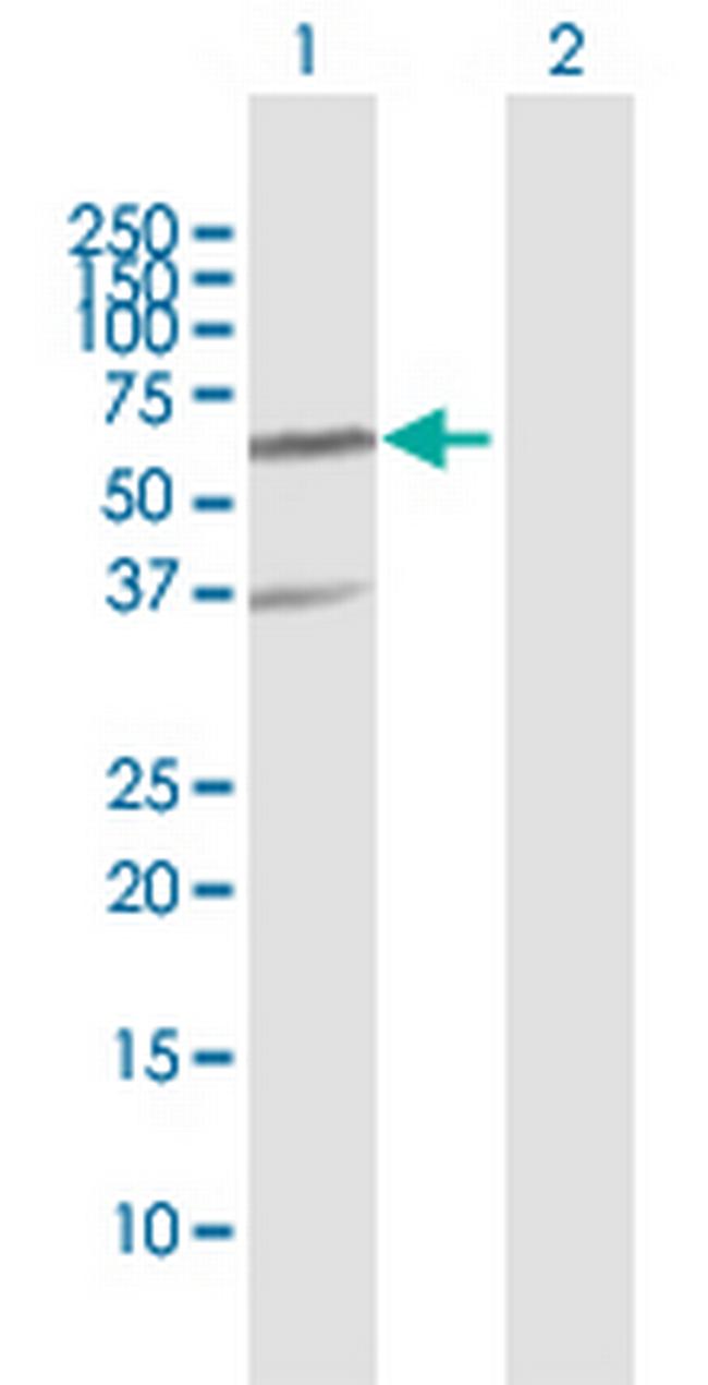 RNF25 Antibody in Western Blot (WB)