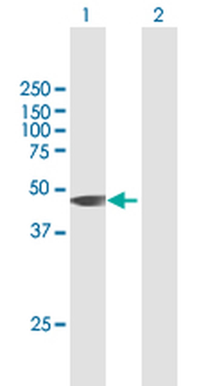 HIF3A Antibody in Western Blot (WB)