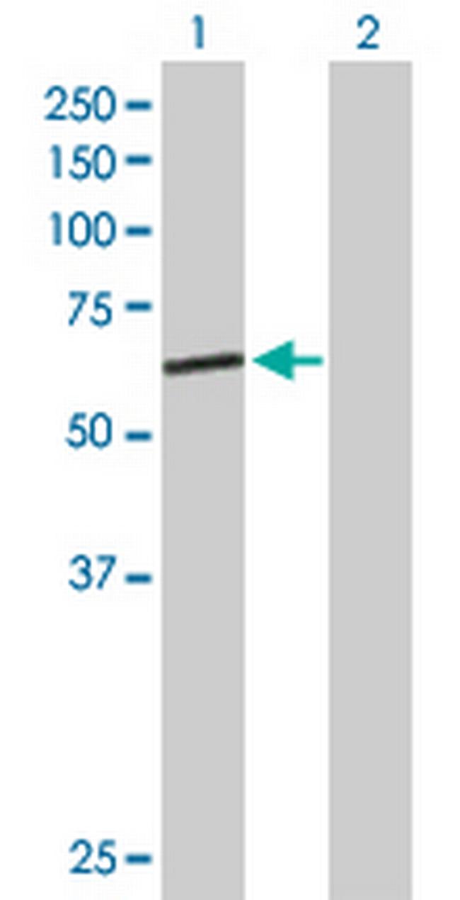 GMCL1L Antibody in Western Blot (WB)