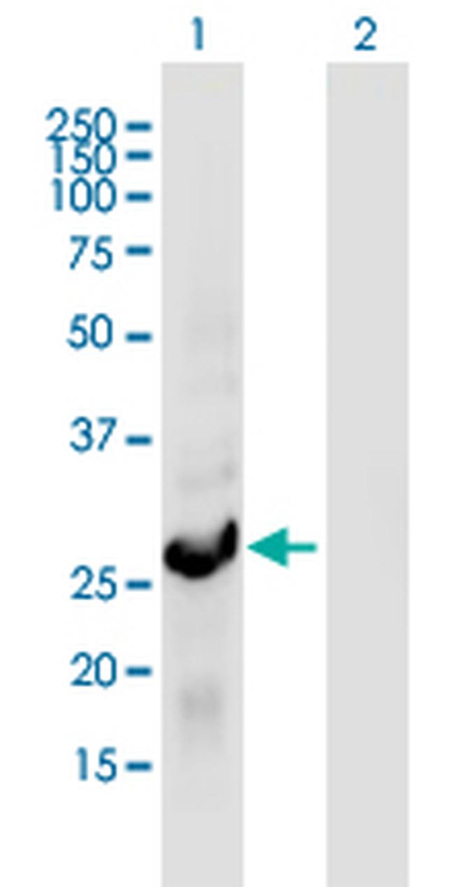 RGS18 Antibody in Western Blot (WB)