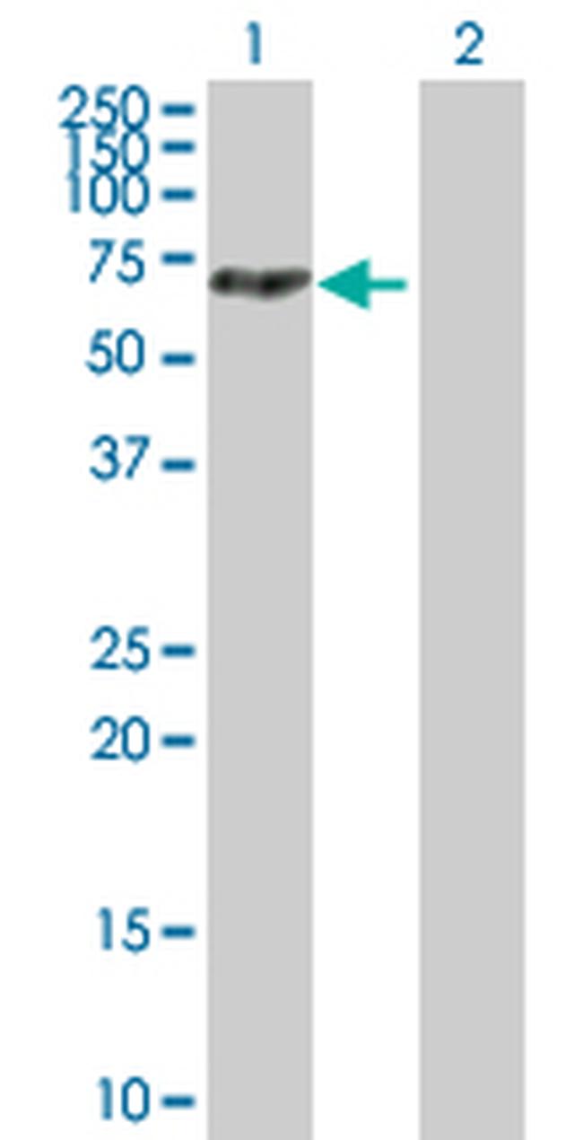 MTMR14 Antibody in Western Blot (WB)