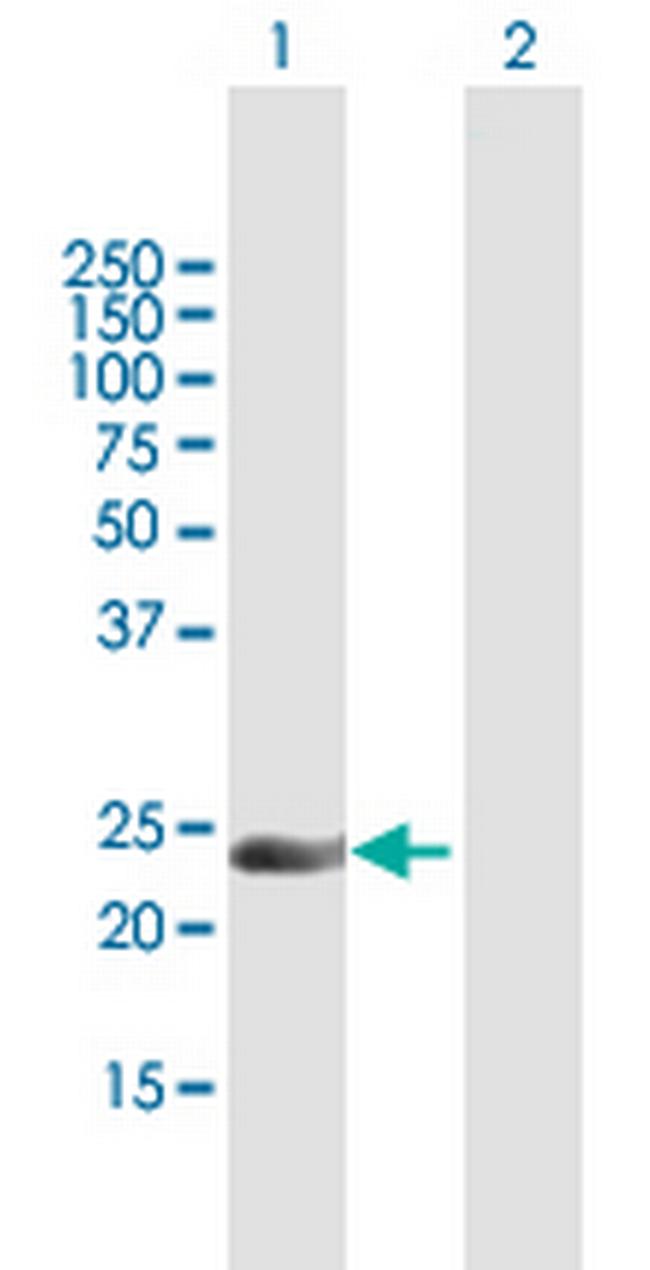 INF2 Antibody in Western Blot (WB)