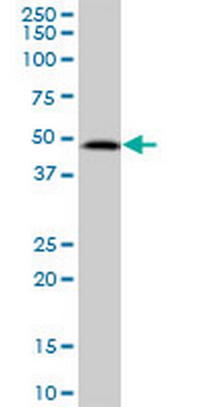SUDS3 Antibody in Western Blot (WB)