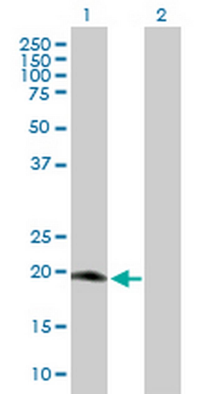 MRPS25 Antibody in Western Blot (WB)