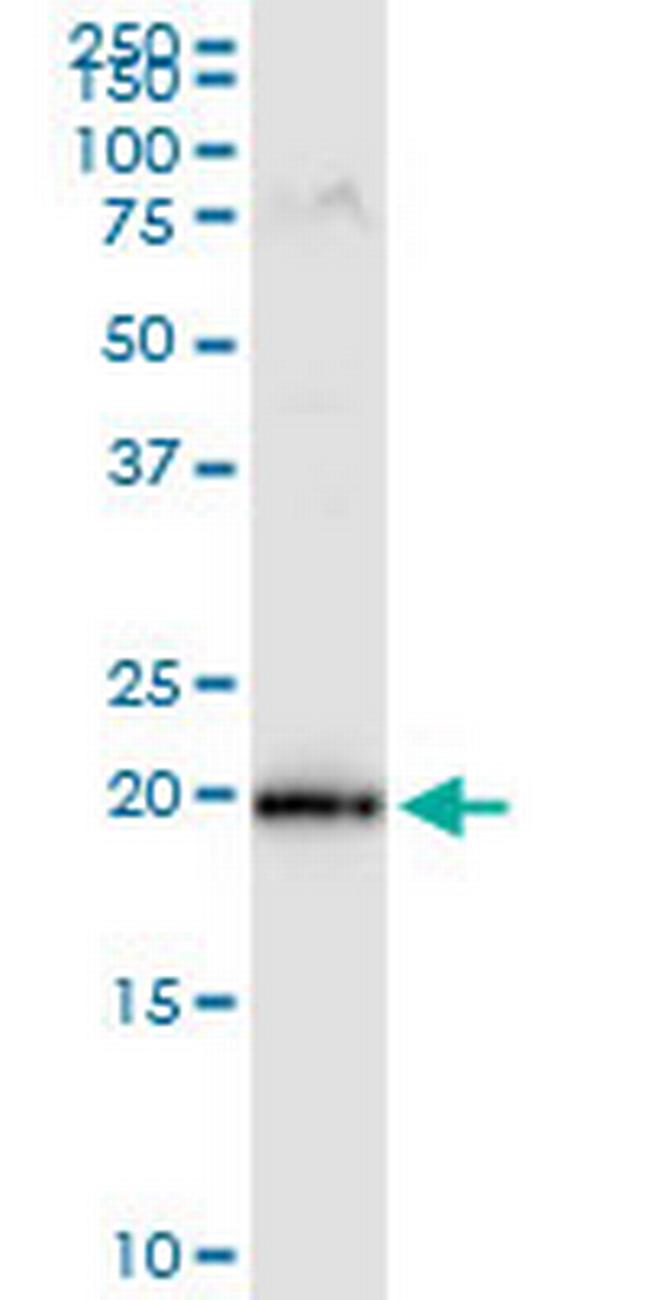 MRPS25 Antibody in Western Blot (WB)