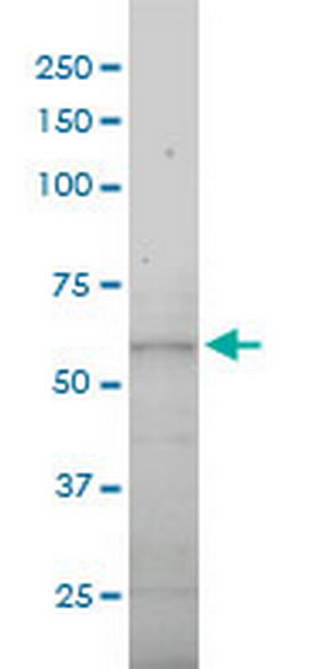 DNAI2 Antibody in Western Blot (WB)