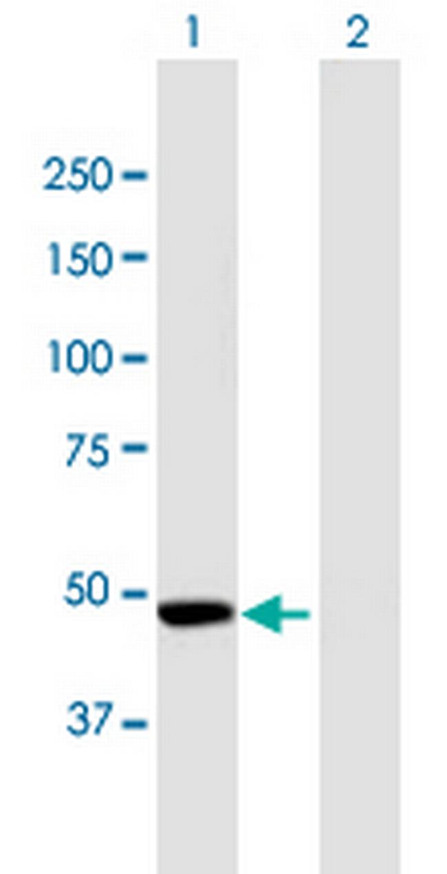CPEB1 Antibody in Western Blot (WB)