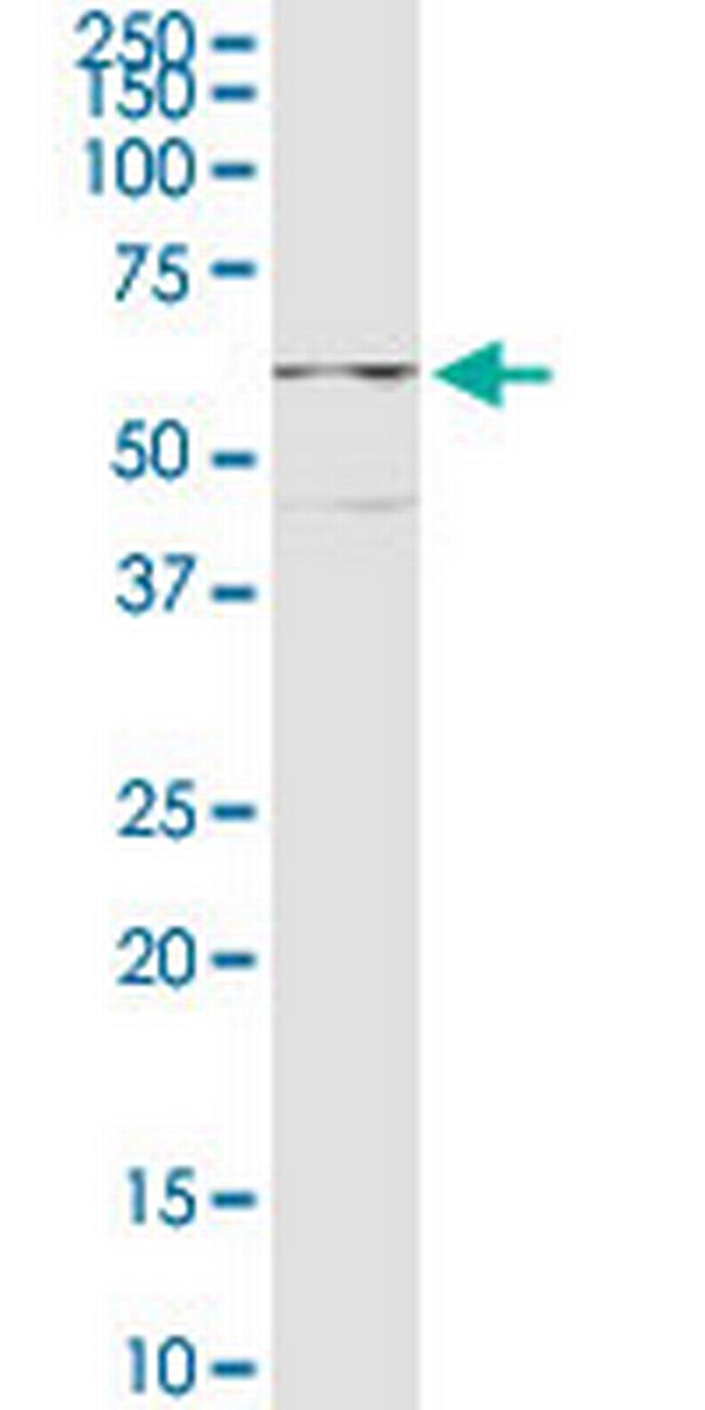 CPEB1 Antibody in Western Blot (WB)