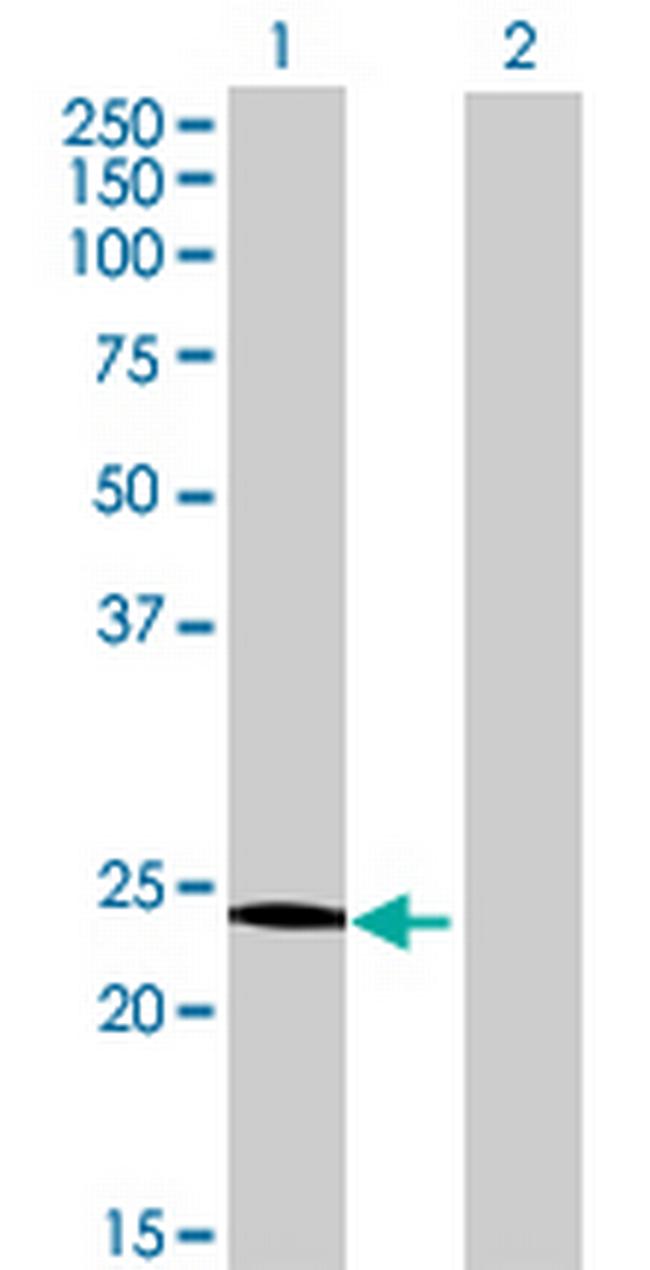 MOSPD3 Antibody in Western Blot (WB)