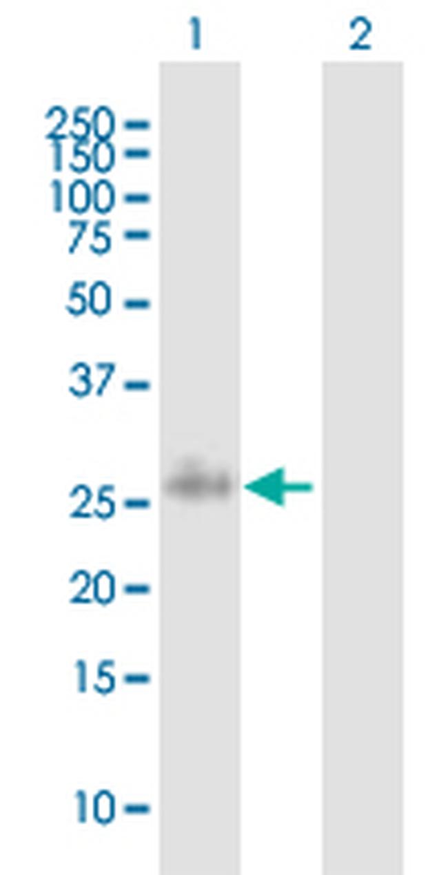 PLA2G2F Antibody in Western Blot (WB)