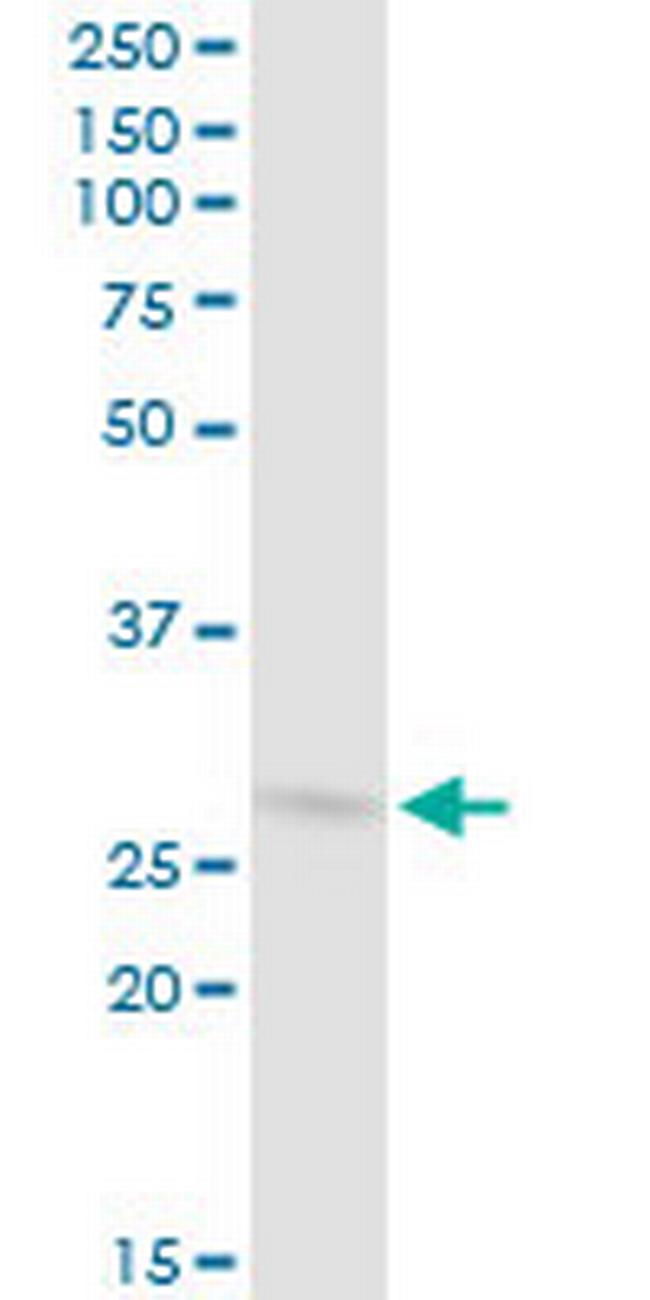 COPS7B Antibody in Western Blot (WB)